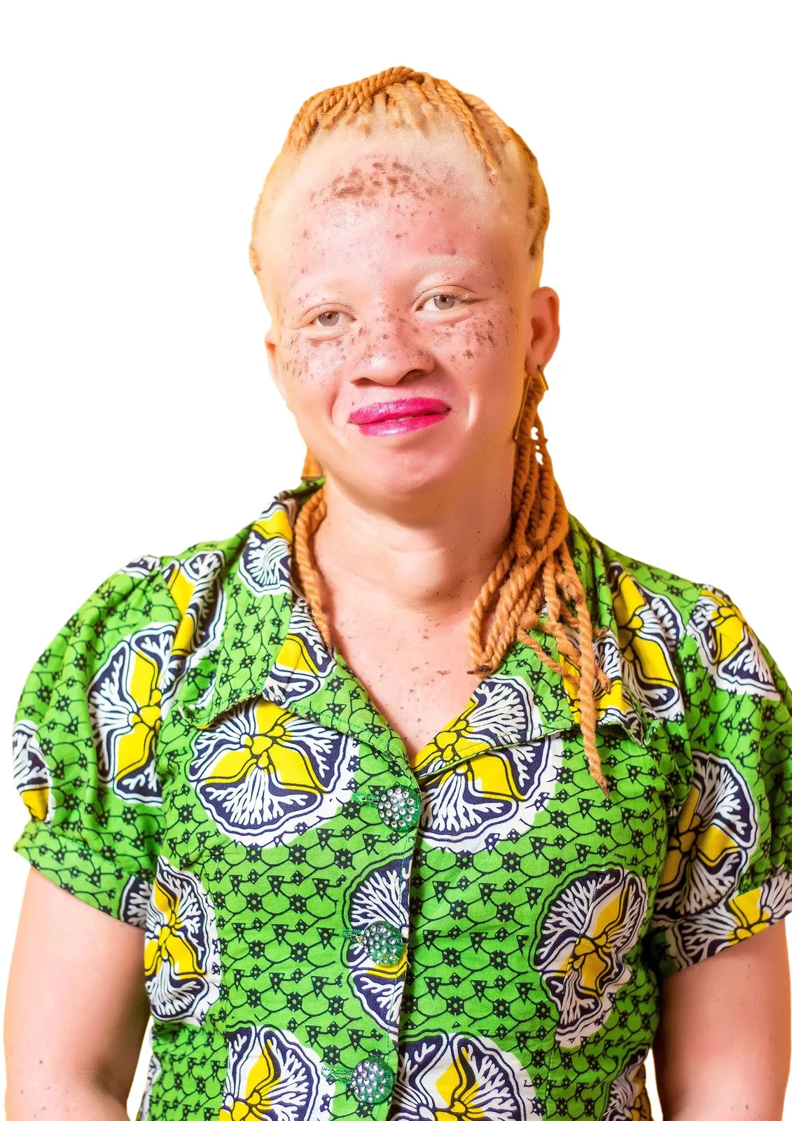 Meet Martha Addo, an aspiring business lady who wants to create jobs for albinos in Ghana